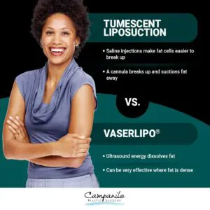 Tumescent Liposuction