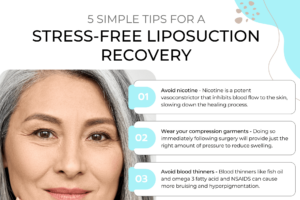 5 Simple Tips for a Stress-Free Liposuction Recovery thumb