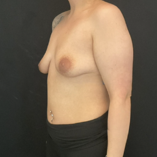 Case 16438 - Before