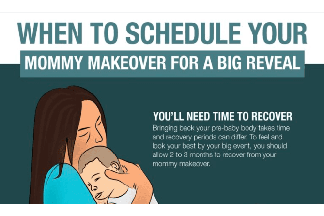 When to Schedule Your Mommy Makeover For a Big Reveal