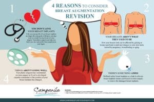 Campanile 4 Reasons to Consider Breast Augmentation Revision