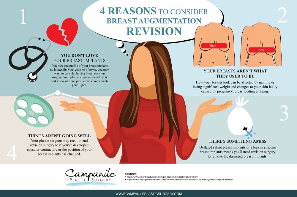 4 Reasons to Consider Breast Augmentation Revision