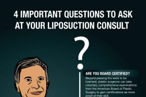 4 Important Questions to Ask at Your Liposuction Consult [Infographic]