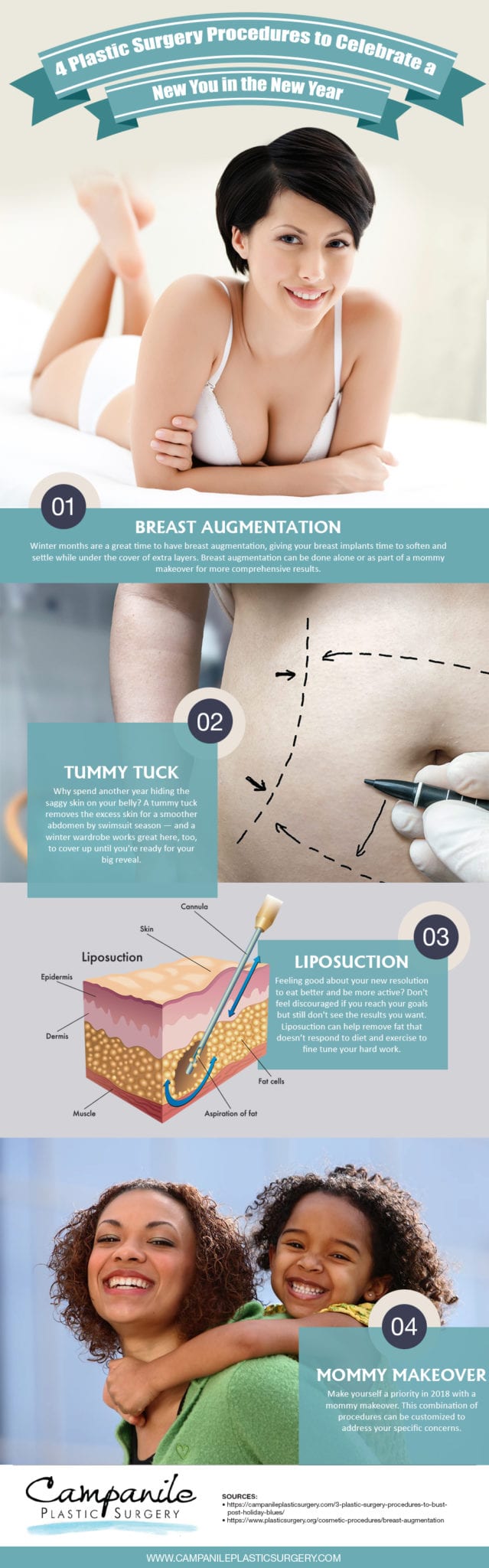 plastic surgery infographic