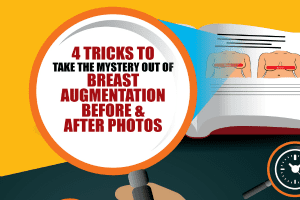 4 Tricks to Take the Mystery Out of Breast Augmentation Before & After Photos [Infographic]