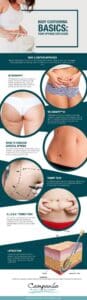 Infographic explaining body contouring options