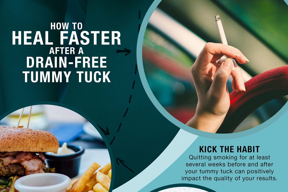 How to Heal Faster After a Drain-Free Tummy Tuck [Infographic]