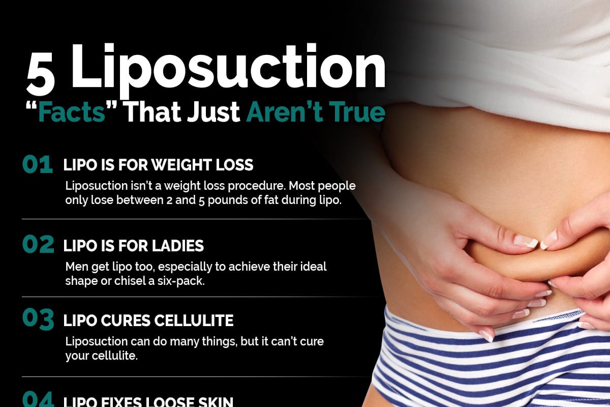 5 Liposuction "Facts" That Just Aren't True [Infographic]