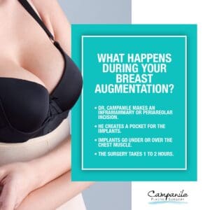 What Happens During Your Breast Augmentation Procedure - Campanile Plastic Surgery, Denver, CO
