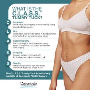 Infographic explaining the CLASS tummy tuck procedure