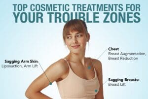 Top Cosmetic Treatments for Your Trouble Zones thumb