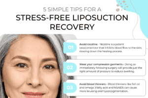 5 Simple Tips for a Stress-Free Liposuction Recovery thumb