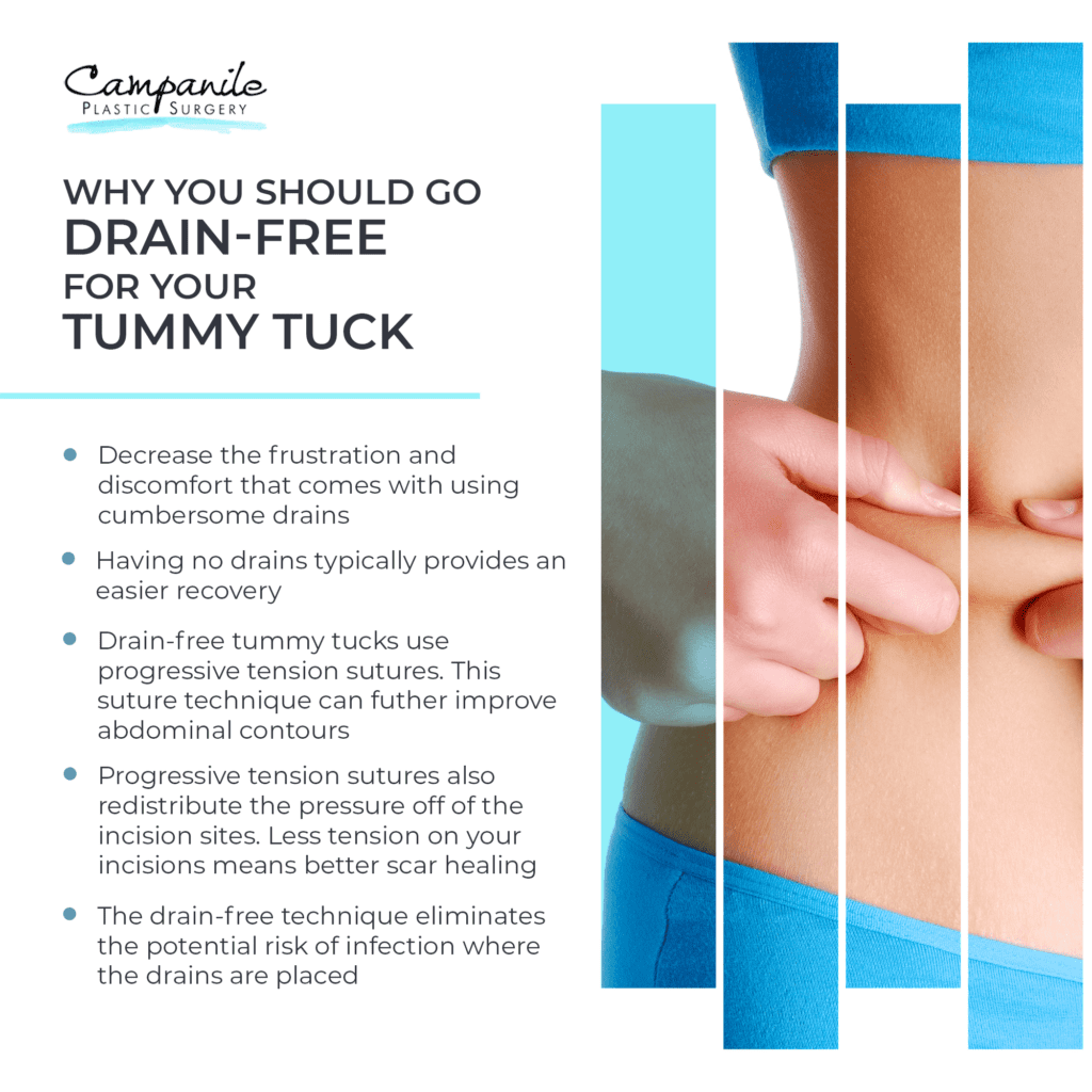  Why You Should Go Drain-Free for Your Tummy Tuck