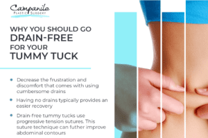 Why You Should Go Drain-Free for Your Tummy Tuck thumb