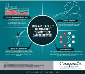 Infographic explaining the benefits of a C.L.A.S.S. drain free tummy tuck