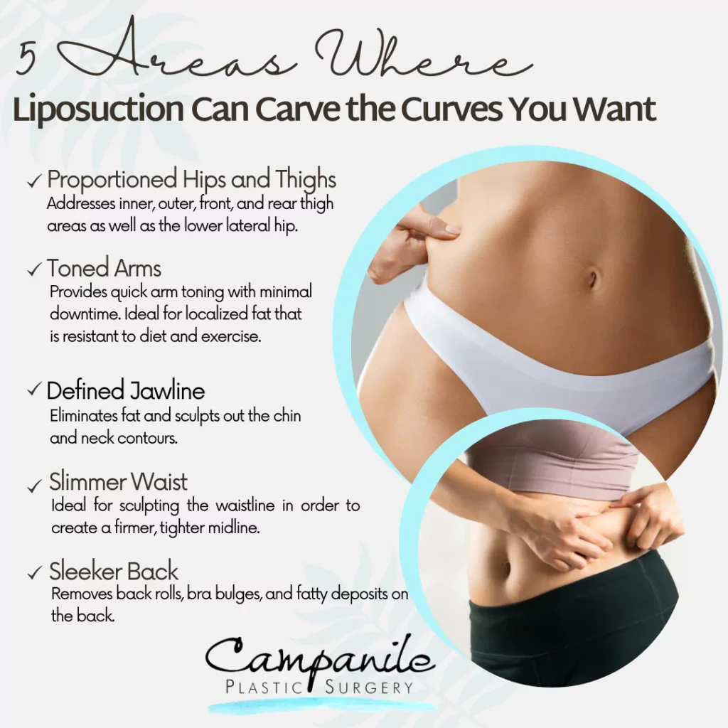5 Areas Where Liposuction Can Carve the Curves You Want