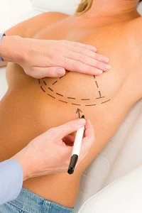 C-Section with Your Tummy Tuck